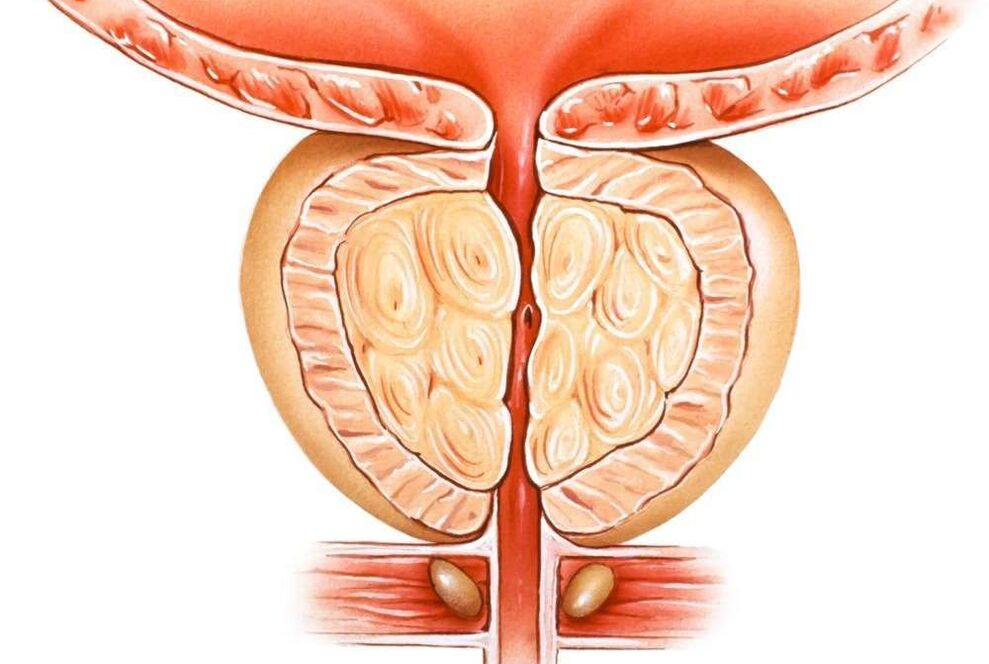 kongestivni prostatitis